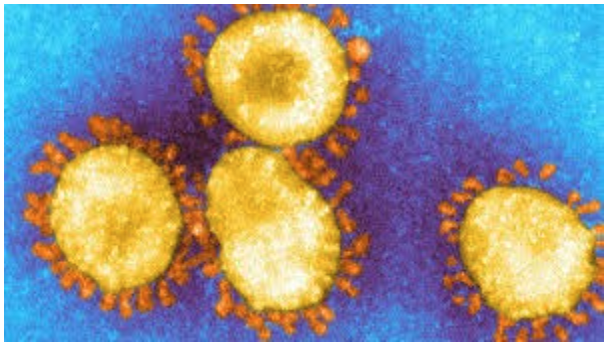 This image displays the UK strain of the Coronavirus under a microscope.